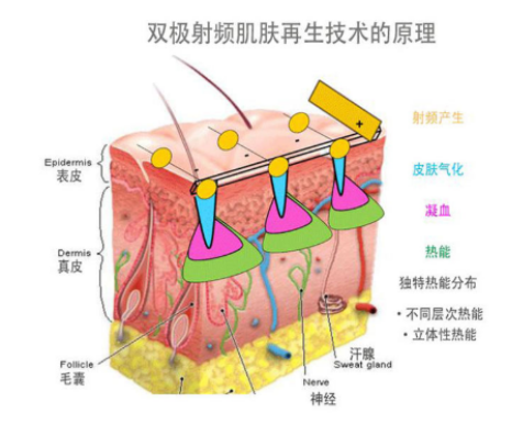 李佳齊推薦的便攜式美容儀,歐姆龍輕觸開關性價比王炸!